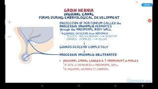 Abdominal Hernias  Osmosis [upl. by Seluj]