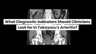 What is Takayasus Arteritis [upl. by Marthe]