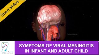 SYMPTOMS OF VIRAL MENINGITIS IN INFANT AND ADULT CHILD [upl. by Nnalorac]