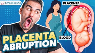 Placental Abruption Symptoms Causes Nursing Interventions  NCLEX Tips [upl. by Strickler306]