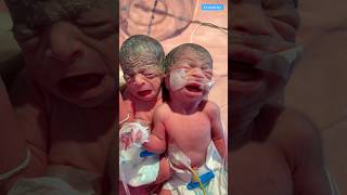 Newborn baby video medical viralvideo [upl. by Atil]