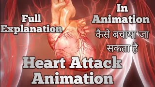 Heart Attack Animation Explanation  How to recognise a heart attack   How To treat Heart Attack [upl. by Rebmit]