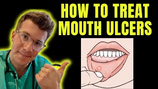 How to recognise and treat Mouth Ulcers getting rid of canker sores  Doctor ODonovan explains [upl. by Attenrev992]