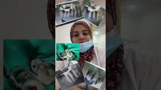 اعلان ويجز الجديد اكسبلور dentist ترند تيكتوك اعلانسامسونج الجديد [upl. by Eatnuahs130]