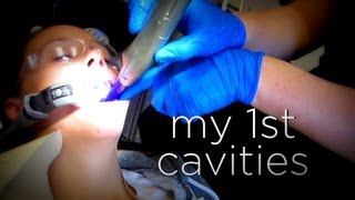 MY FIRST CAVITIES [upl. by Zennas]