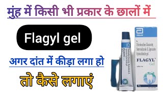 Flagyl gel  मुंह के छालों की दमदार दवाई। दांत में कीड़ा अगर दर्द दे तो इसका उपयोग करे। कैसे लगाएं [upl. by Iralav]