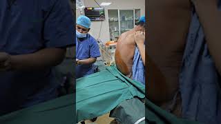 Spinal Anaesthesia for Low Cardiac Reserve patient low EFanesthesia spinal [upl. by Abercromby574]