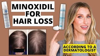 Dermatologist Explains How Minoxidil Works for Hair Loss How to Use Results amp More [upl. by Hoshi]