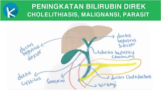 Patofisiologi Ikterus 2B2B  Peningkatan Bilirubin Direk Kolestasis Ekstrahepatik [upl. by Radbun]