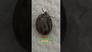 😱🩸🔥Bloodengorged Tick A Nasty Encounter👍🔥🩸😱Напившийся Крови Клещ👍 [upl. by Arima520]