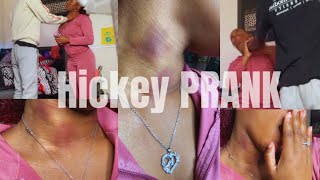 Hickey Prank On My Protective boyfriend got heated [upl. by Einnhoj208]