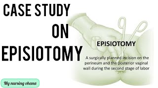 Case study on Episiotomy 👩‍⚕️✂️ its important project in obgcasestudy casepresentationnotes [upl. by Kendrick]