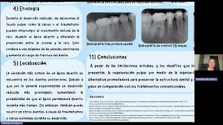 INGENIERÍA TISULAR EN LA REGENERACIÓN PULPAR DE DIENTES CON ÁPICE ABIERTO [upl. by Elwee474]