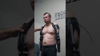 Victor Bilateral TransHumeral Prosthetic Elbow Placement  Prosthetic Innovations [upl. by Katerina]