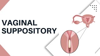 Vaginal Suppository Insertion  How to put It Safely and Easily [upl. by Ahs707]