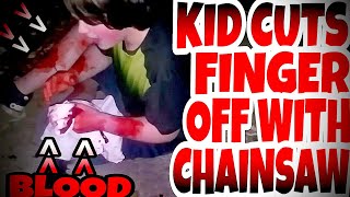 KID CUTS HIS FINGER OFF WITH CHAINSAW PRANK [upl. by Anairotciv]