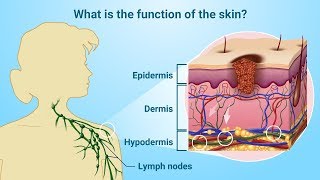 Understanding Melanoma [upl. by Noxin376]