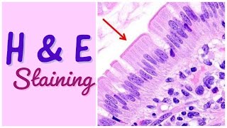 H amp E staining  Hematoxylin amp Eosin staining [upl. by Magbie]