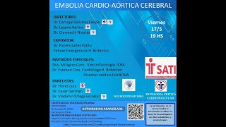 WEBINAR EMBOLIA CARDIOAORTICA CEREBRAL [upl. by Olinde443]