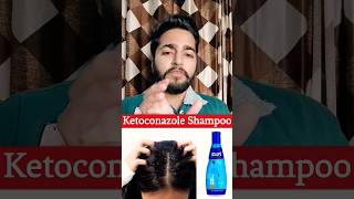 Ketoconazole Shampoos For Dandruff sahilnagpal ytshorts viral [upl. by Ynar991]