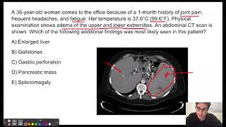 USMLE Step 1 Question of the Day 4 Felty Syndrome [upl. by Nhor184]