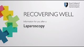 Laparoscopy  Information for you on recovering well  RCOG [upl. by Anihpesoj896]