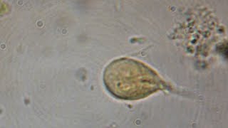 Giardia Lamblia CIAB wwwciabes [upl. by Pascoe]