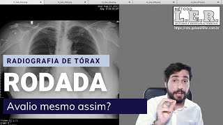 Radiografia de tórax Rodada é o fim do mundo O que fazer  Galvani Filho [upl. by Adnav722]