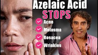 Skinoren cream 20Azelaic acid How to use azelaic acid skincare 20 azelaic acidshortsazelaicacid [upl. by Solon]