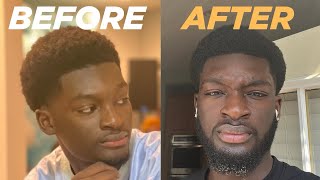 How to Grow a Full Beard in 6 Months  My Proven Beard Growth Journey [upl. by Aksehcnarf]