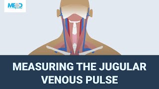 Measuring the jugular venous pulse [upl. by Gone903]