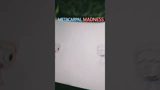 METACARPAL MADNESS [upl. by Falzetta]