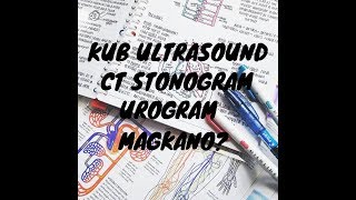 Magkano KUB Ultrasound CT Stonogram at UROGRAM [upl. by Galliett992]