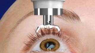 Unique DIATON Tonometry Through Eyelid  with Diaton Tonometer  Introduction  Description Part1 [upl. by Ahsiekit]