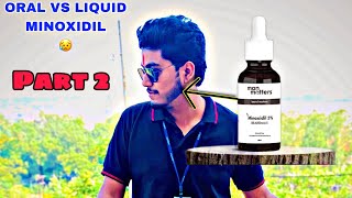 All products MinoxidilBeard gummies Derma roller Review  Oral vs Liquid minoxidil  Man matters [upl. by Sivahc]