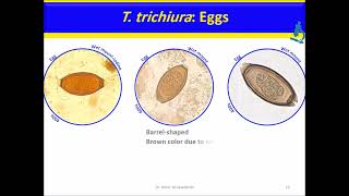 Trichuris trichiura Nematodes [upl. by Anaic]