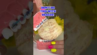 DONT DO THIS WITH BRACES 👀 FRUITS and VEGGIES to AVOID ORTHODONTIST REACTS SATISFYING FOOD ASMR [upl. by Attemaj670]