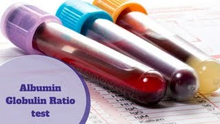 Albumin and Globulin AG Ratio [upl. by Hartman]