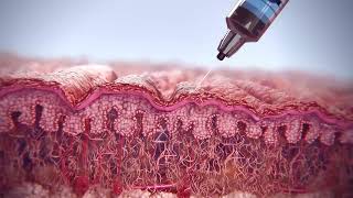 Mechanism of Action of Sculptra® from Galderma [upl. by Pride]