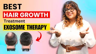 Exosome Hair Growth Treatment Revolutionary Solution for Hair Fall amp Hair Loss  Dr Sneha Gupta MD [upl. by Wilcox]