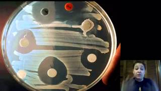 Kingdoms Part 2 Archaebacteria and Eubacteria [upl. by Notsehc]