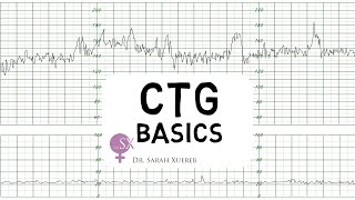 CTG Basics [upl. by Hartzel405]