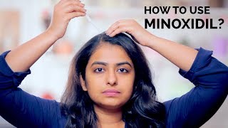 How To Use Minoxidil  Hair Regrowth  Skin Diaries [upl. by Airednaxela]