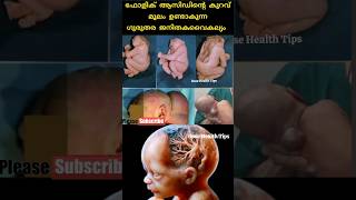 ✅ഗർഭിണി ഒരിക്കലും Follic acid കഴിക്കാതെ ഇരിക്കരുത് 🙏Neural tube diffectpregnancy education [upl. by Ahsekan]