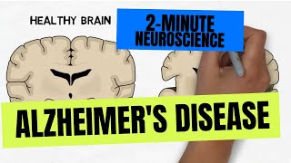 2Minute Neuroscience Alzheimers Disease [upl. by Airret]