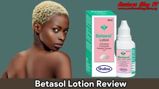 Betasol Lotion Review The Best Treatment Oil For All Skin Types [upl. by Everick]