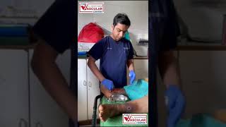 How To Do Dressing of Varicose Ulcer  Dr Ashank Bansal mumbai ulcertreatment [upl. by Fisuoy]