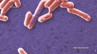 CarbapenemResistant Enterobacteriaceae CRE [upl. by Bixby635]