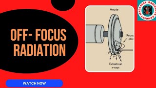 OFF FOCUS RADIATION radiation xray anode cathode  x ray tube [upl. by Garek104]