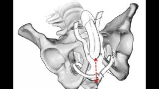 Incontinence urinaire de lhomme quels traitements [upl. by Ernald]